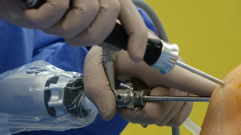 Is Knee Replacement Safe for Diabetic and BP Patients?